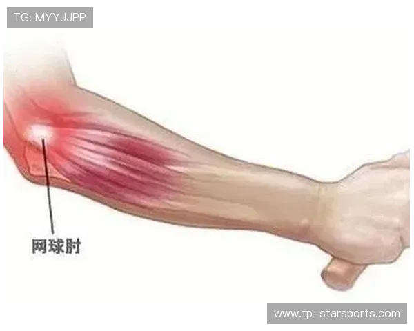 高尔夫球肘：和网球肘相反，你分清了吗？，高尔夫网球肘的症状